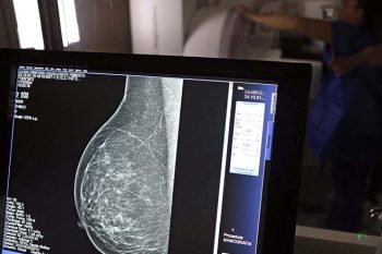 mamografia capa