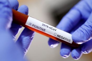 Secretários de Estado de Saúde clamam por posicionamentos unificados que partam do Governo Federal para enfrentar o pior da pandemia. Foto: Agência Brasil