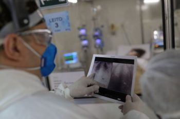 Internações em queda, avanço da vacinação e testagem em massa levaram governo a decidir pela concentração do atendimento aos casos mais graves de Covid-19 apenas no HU. Foto: Arquivo AgBr