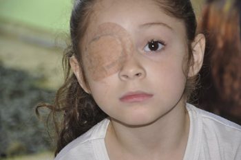 Yasmim Emanuelle teve que ser submetida a uma enucleação, que é a retirada do globo ocular, por causa de um câncer