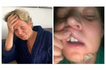 O caso da deputada Joice é muito sério para ser deixado solto no ar pelos jornalistas