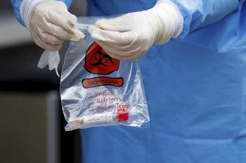 Testes transportados sob proteção sanitária | Foto AGÊNCIA BRASIL